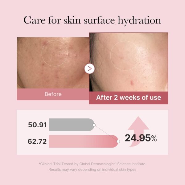Sérum Facial Medicube PDRN Pink Glutathione Serum Mist - 100ml - Imagem 3