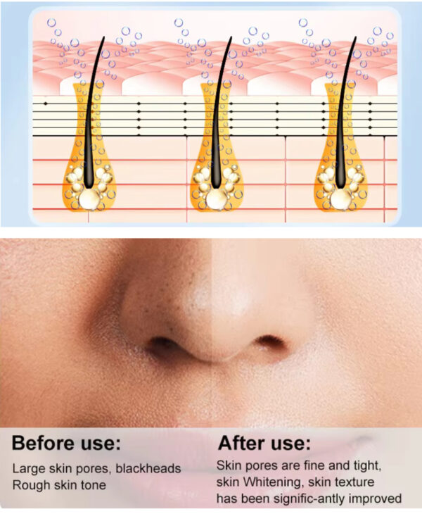 Super Micro Bubble Beauty Instrument - Imagem 5
